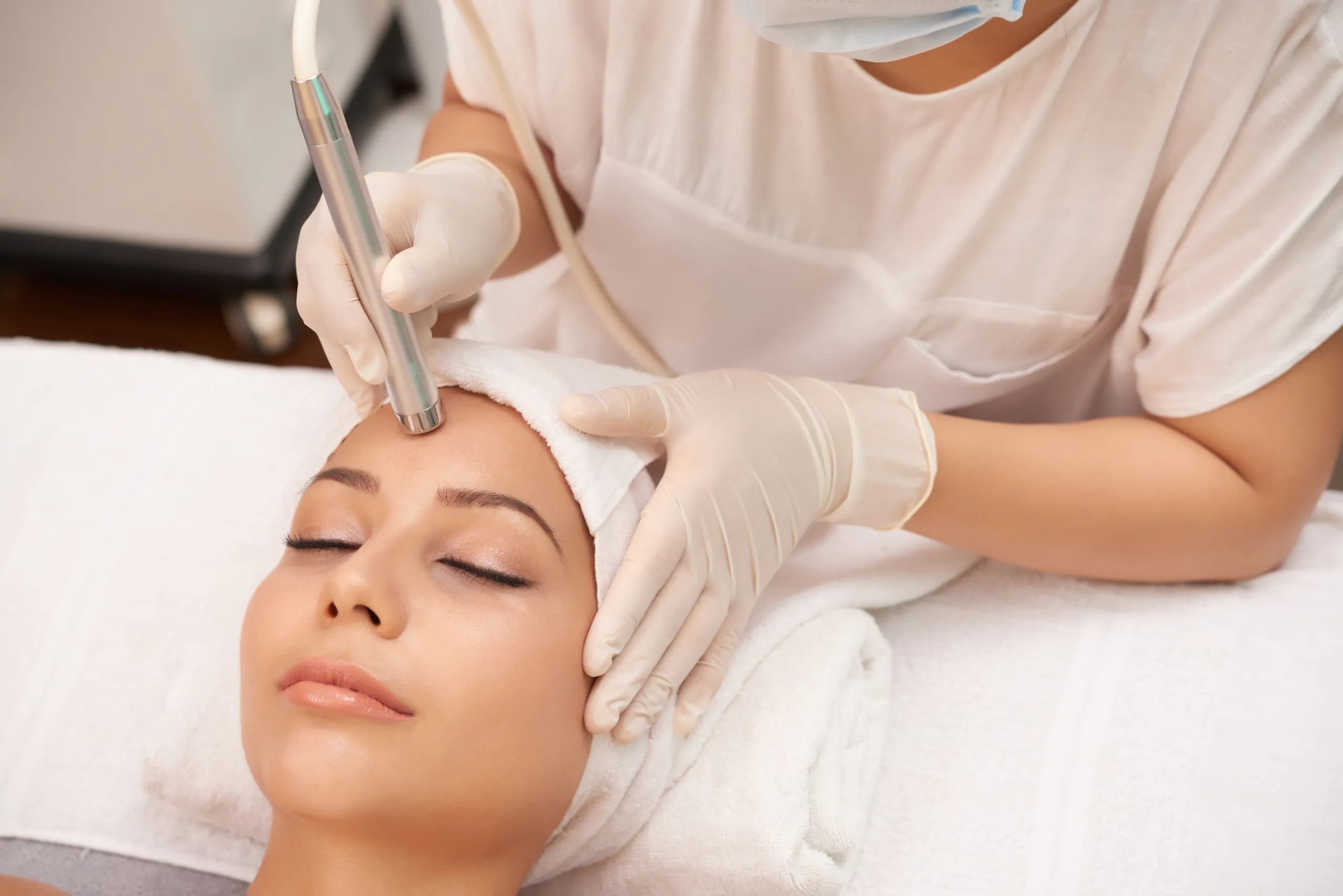 Microneedling-Behandlung im Gesicht bei Lazura Hair Laser in Hausham